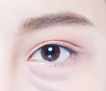 middleEyeUnderstep이미지